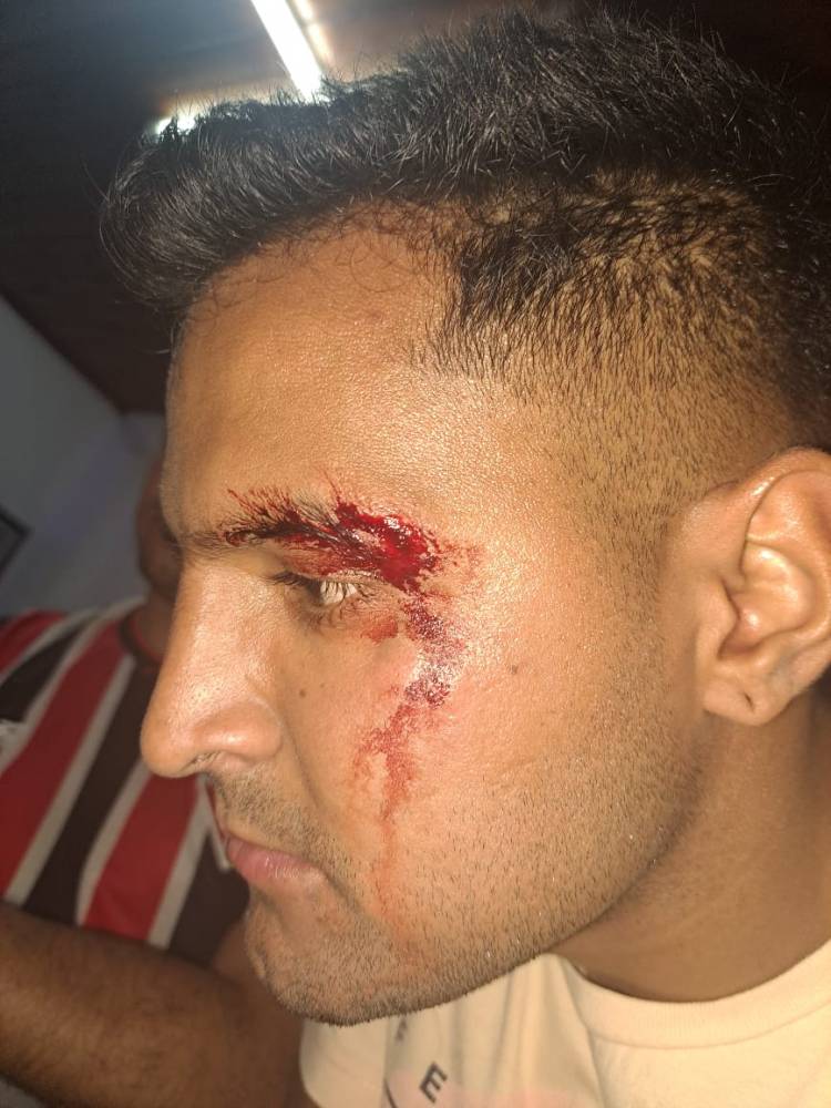 TRES EMPLEADOS POLICIALES LESIONADOS AL INTENTAR APREHENDER A UN CIUDADANO POR ROBO